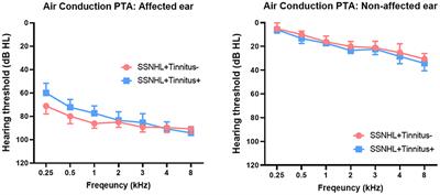 Cortical Oscillatory Signatures Reveal the Prerequisites for Tinnitus Perception: A Comparison of Subjects With Sudden Sensorineural Hearing Loss With and Without Tinnitus